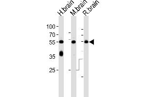 Western Blotting (WB) image for anti-Protein Kinase C and Casein Kinase Substrate in Neurons 1 (PACSIN1) (AA 8-38), (N-Term) antibody (ABIN392664)