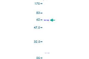 Image no. 1 for Ribosomal Protein S6 (RPS6) (AA 1-249) protein (GST tag) (ABIN1318818) (RPS6 Protein (AA 1-249) (GST tag))