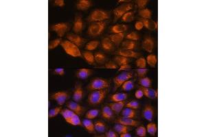 Immunofluorescence analysis of HeLa cells using A antibody (ABIN1678588, ABIN3015506, ABIN3015508 and ABIN6218562) at dilution of 1:100.