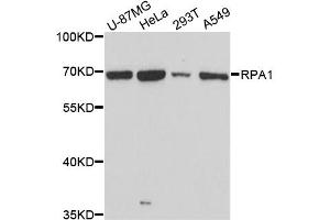 Western blot analysis of extracts of various cell lines, using RPA1 antibody. (RPA1 antibody)
