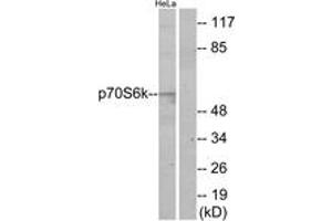 Western blot analysis of extracts from HeLa cells, using p70 S6 Kinase (Ab-424) Antibody. (RPS6KB1 antibody  (AA 414-463))