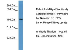WB Suggested Anti-B4galt5 Antibody Titration:  0. (B4GALT5 antibody  (C-Term))