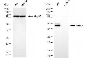 anti-Hematopoietically Expressed Homeobox (HHEX) antibody
