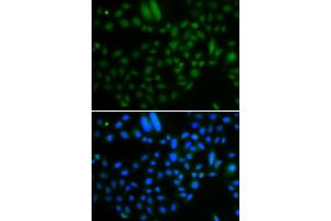 Immunofluorescence analysis of A549 cells using ALKBH8 antibody (ABIN5974297). (ALKBH8 antibody)