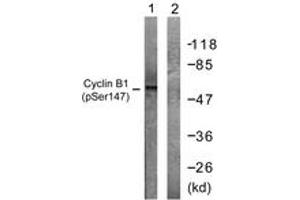 Western blot analysis of extracts from Jurkat cells treated with UV 15', using Cyclin B1 (Phospho-Ser147) Antibody. (Cyclin B1 antibody  (pSer147))