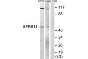 Western blot analysis of extracts from LOVO/RAW264. (SRSF11 antibody  (AA 211-260))