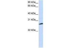 SYCP3 antibody used at 1 ug/ml to detect target protein. (SYCP3 antibody  (N-Term))