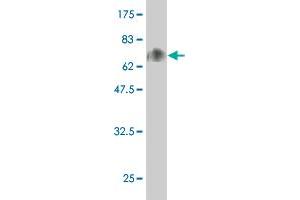 Western Blot detection against Immunogen (69. (CD43 antibody  (AA 1-400))