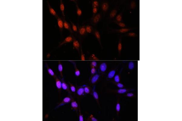 MYST3 antibody  (AA 800-1000)
