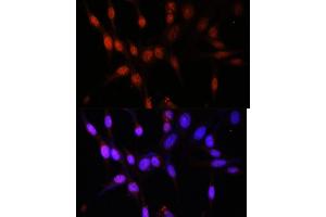 Immunofluorescence analysis of NIH/3T3 cells using KA antibody (ABIN7268768) at dilution of 1:100.