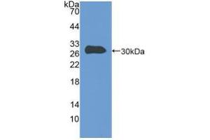 Western blot analysis of recombinant Human TLN. (Talin antibody  (AA 2293-2536))