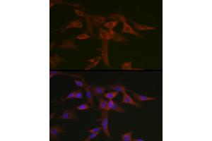 Immunofluorescence analysis of C6 cells using STA Rabbit pAb (ABIN6128540, ABIN6148576, ABIN6148578 and ABIN6223670) at dilution of 1:50 (40x lens). (STAT5A antibody  (AA 635-794))