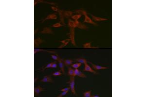 Immunofluorescence analysis of C6 cells using STA Rabbit pAb (ABIN6128540, ABIN6148576, ABIN6148578 and ABIN6223670) at dilution of 1:50 (40x lens). (STAT5A antibody  (AA 635-794))
