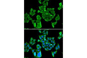 Immunofluorescence analysis of HeLa cells using CCAR1 antibody. (CCAR1 antibody)