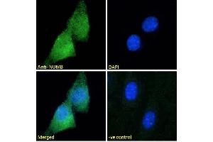 Immunofluorescence (IF) image for anti-Numb Homolog (NUMB) (C-Term) antibody (ABIN184679)