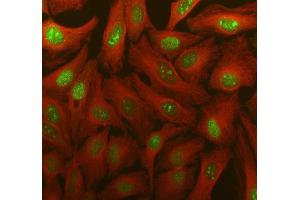 IF analysis of TDG using anti-TDG antibody (ABIN7600107) and anti-Tubulin Alpha antibody (ABIN7600339). (TDG antibody  (AA 15-370))