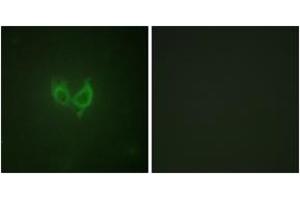 Immunofluorescence analysis of HuvEc cells, using MARK2 (Ab-596) Antibody. (MARK2 antibody  (AA 562-611))