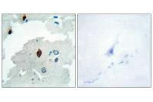 Immunohistochemistry analysis of paraffin-embedded human brain tissue using PTTG antibody. (PTTG1IP antibody  (C-Term))