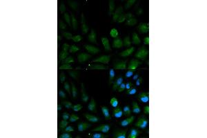 Immunofluorescence analysis of HepG2 cell using CAPZA2 antibody. (CAPZA2 antibody)