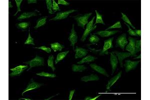 Immunofluorescence of purified MaxPab antibody to GRIPAP1 on HeLa cell. (GRIPAP1 antibody  (AA 1-841))