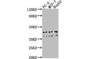 Western Blot Positive WB detected in: PC-3 whole cell lysate, MCF-7 whole cell lysate, HepG2 whole cell lysate All lanes: RHBDD3 antibody at 1:1000 Secondary Goat polyclonal to rabbit IgG at 1/50000 dilution Predicted band size: 41 kDa Observed band size: 41 kDa (RHBDD3 antibody  (AA 304-323))