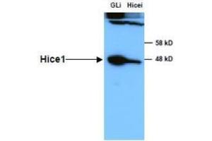 Anti-HICE1 in Western Blot using  Immunochemicals' Anti-HICE1 Antibody shows detection of a 45 kDa band corresponding to endogenous HICE1 in lysates of S phase HeLa cells silenced for either control Luciferase or HICE1.