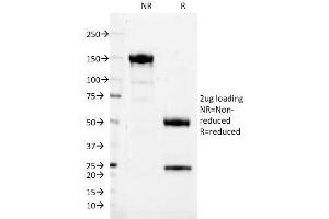 SDS-PAGE Analysis Purified CD37 Mouse Monoclonal Antibody (IPO24). (CD37 antibody)