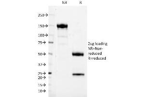 SDS-PAGE Analysis Purified CD37 Mouse Monoclonal Antibody (IPO24).