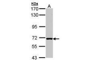 Image no. 1 for anti-RAS Guanyl Releasing Protein 2 (Calcium and DAG-Regulated) (RASGRP2) (AA 299-609) antibody (ABIN467507) (RASGRP2 antibody  (AA 299-609))