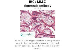 Image no. 1 for anti-Malectin (MLEC) (Internal Region) antibody (ABIN1736973) (Malectin antibody  (Internal Region))