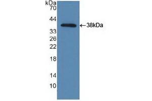 Western blot analysis of recombinant Human TBK1. (TBK1 antibody  (AA 9-310))