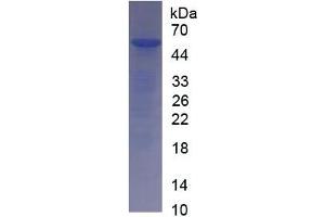 SDS-PAGE (SDS) image for Interleukin 35 (IL35) ELISA Kit (ABIN6574300)
