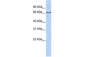 SLC27A6 antibody used at 1 ug/ml to detect target protein.