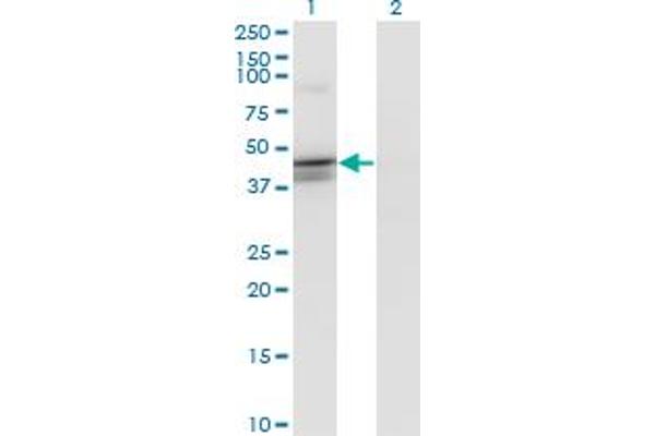 CANT1 antibody  (AA 302-401)