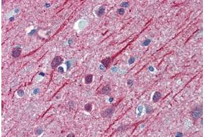 Human Brain, Cortex: Formalin-Fixed, Paraffin-Embedded (FFPE) (TUBB2A antibody  (AA 1-446))