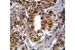 Immunohistochemistry (IHC) image for anti-Carbamoyl-Phosphate Synthetase 2, Aspartate Transcarbamylase, and Dihydroorotase (CAD) (AA 780-809) antibody (ABIN3030276)