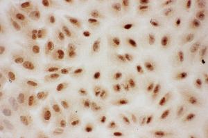 Immunohistochemistry (IHC) image for anti-Protein Inhibitor of Activated STAT, 1 (PIAS1) (AA 636-651), (C-Term) antibody (ABIN3044474)