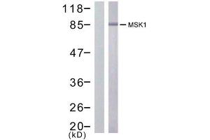 Western blot analysis of extract from HuVec cells treated or untreated with PMA (200nM, 30min), using MSK1 (Ab-376) antibody (E021198). (MSK1 antibody)