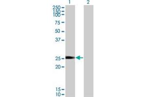 Western Blot analysis of NXNL1 expression in transfected 293T cell line by TXNL6 monoclonal antibody (M01), clone 7H3.