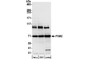 anti-Phosphoglucomutase 2 (PGM2) (AA 175-225) antibody