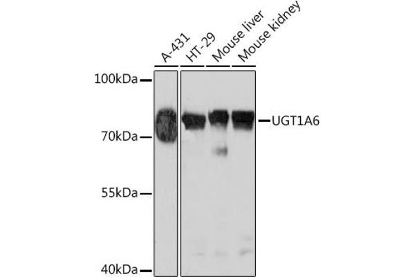 UGT1A6 antibody  (AA 65-270)