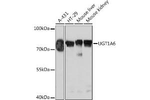 Western blot analysis of extracts of various cell lines, using UGT1 Rabbit pAb (ABIN7271193) at 1:1000 dilution. (UGT1A6 antibody  (AA 65-270))