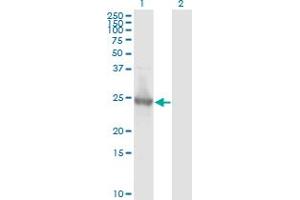 Western Blot analysis of KIRREL2 expression in transfected 293T cell line by KIRREL2 monoclonal antibody (M01), clone 2B9-1D3. (KIRREL2 antibody  (AA 1-219))