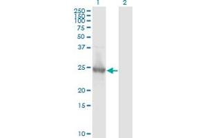 Western Blot analysis of KIRREL2 expression in transfected 293T cell line by KIRREL2 monoclonal antibody (M01), clone 2B9-1D3.