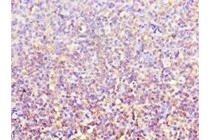 Immunohistochemistry of paraffin-embedded human tonsil tissue using ABIN7143106 at dilution of 1:100 (ACTR3B antibody  (AA 189-418))