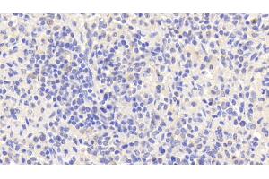 Detection of EMR1 in Human Spleen Tissue using Polyclonal Antibody to EGF Like Module Containing Mucin Like Hormone Receptor 1 (EMR1) (F4/80 antibody  (AA 1-201))