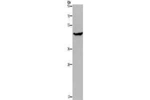 Western Blotting (WB) image for anti-Acid Phosphatase 6, Lysophosphatidic (ACP6) antibody (ABIN2430391) (ACP6 antibody)