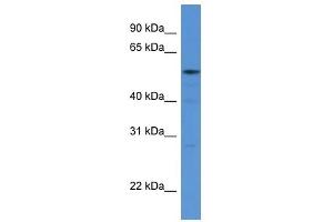 Western Blot showing HARS antibody used at a concentration of 1 ug/ml against 293T Cell Lysate