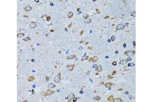 Immunohistochemistry of paraffin-embedded Mouse brain using RARS Polyclonal Antibody at dilution of 1:100 (40x lens). (RARS antibody)