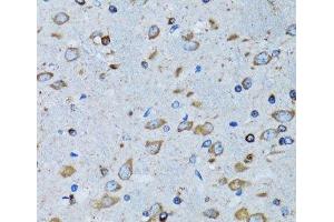 Immunohistochemistry of paraffin-embedded Mouse brain using RARS Polyclonal Antibody at dilution of 1:100 (40x lens). (RARS antibody)